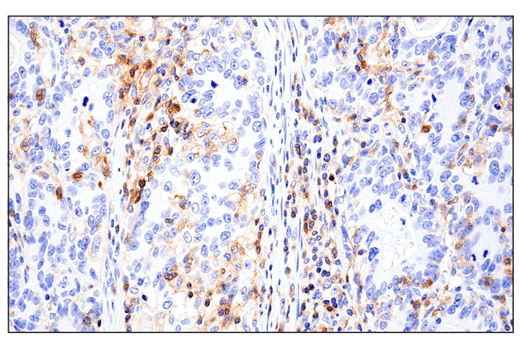 Immunohistochemistry Image 5: CD11 alpha (E5S9K) Rabbit Monoclonal Antibody