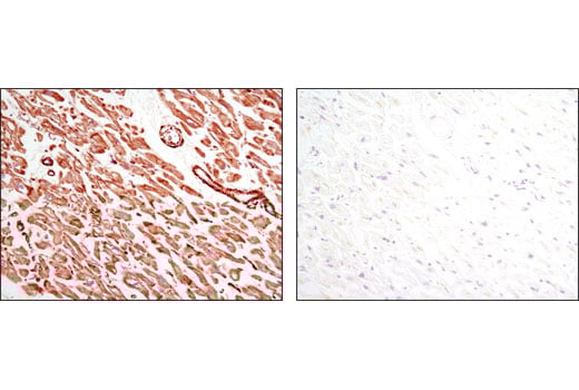 Immunohistochemistry Image 2: Pan-Actin (D18C11) Rabbit Monoclonal Antibody (BSA and Azide Free)