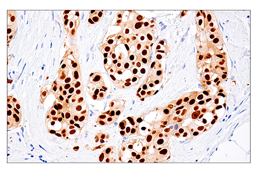 Immunohistochemistry Image 1: MAGE-A10 (E9V2Q) Rabbit Monoclonal Antibody
