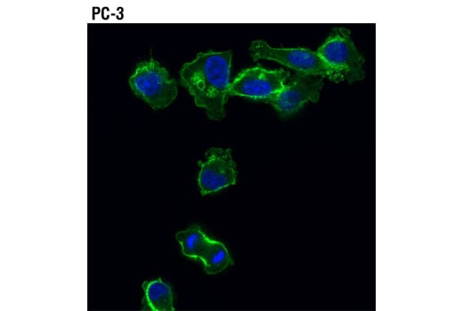 Immunofluorescence Image 1: Merlin (D3S3W) Rabbit Monoclonal Antibody