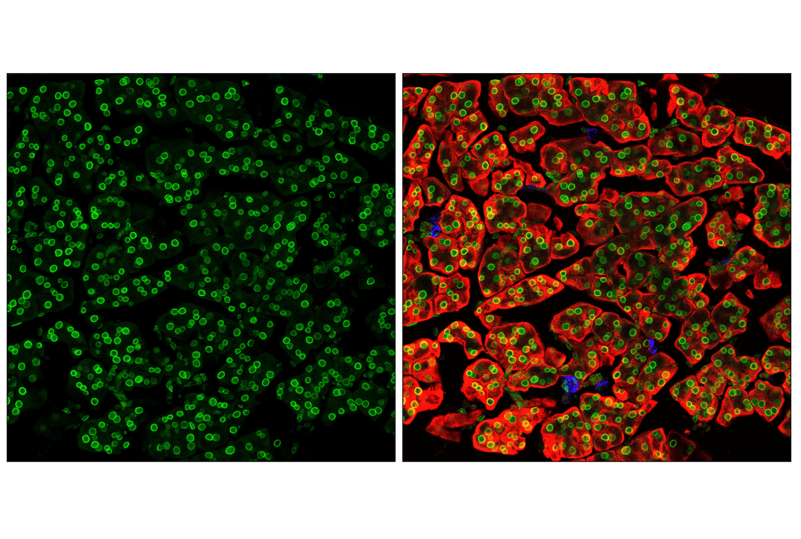 Immunofluorescence Image 2: NUP153 (E3N3Y) Rabbit Monoclonal Antibody