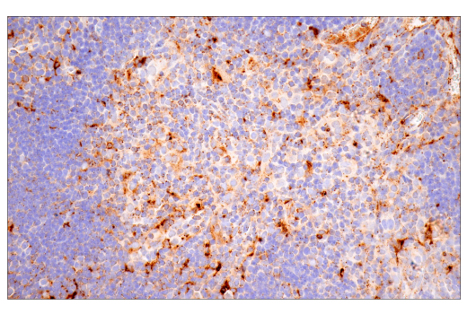 undefined Image 22: PICALM Signaling Antibody Sampler Kit