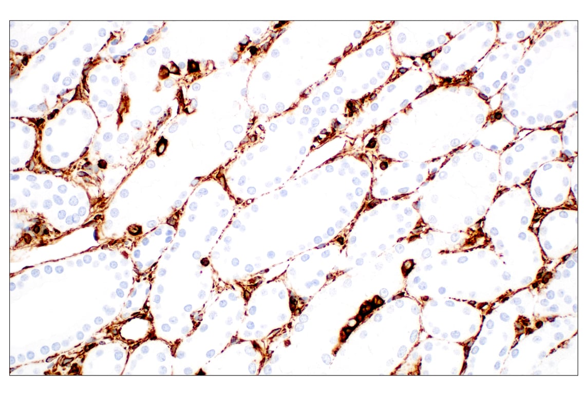 Immunohistochemistry Image 4: Vimentin (D21H3) Rabbit Monoclonal Antibody