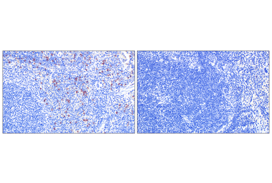 Immunohistochemistry Image 4: NCR1/NKp46 (F8M2L) Rabbit Monoclonal Antibody (IHC Formulated)