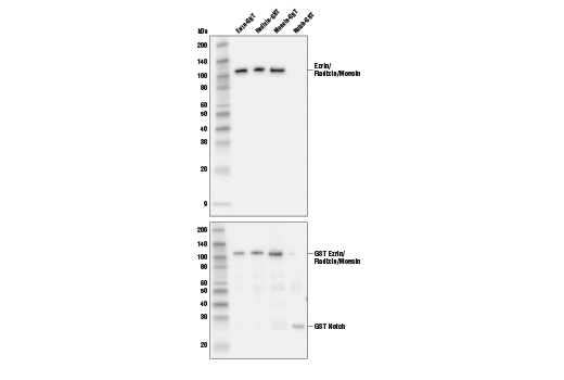 Western Blotting Image 2: Merlin/Ezrin/Radixin/Moesin (D1P8I) Rabbit Monoclonal Antibody