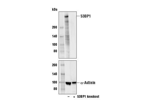 Western Blotting Image 1: 53BP1 (E7N5D) XP<sup>®</sup> Rabbit mAb