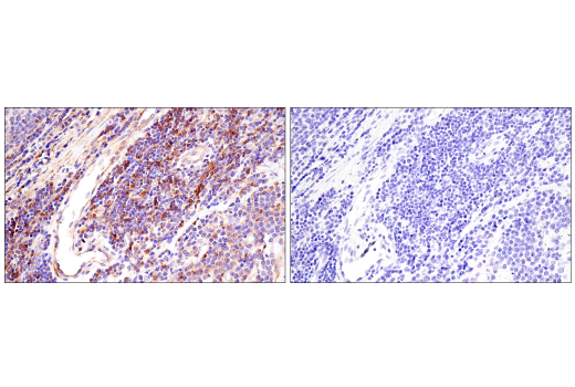 Immunohistochemistry Image 12: CD99 (PCB1) Mouse mAb