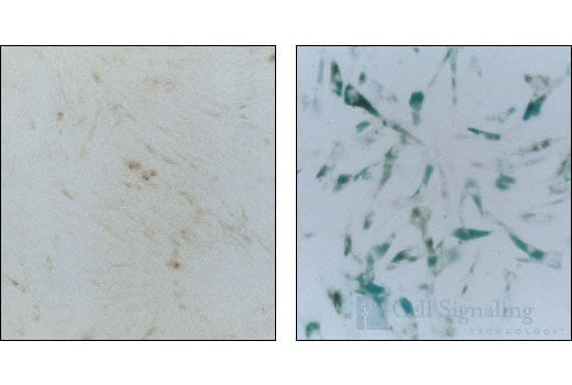 undefined Image 2: Senescence beta-Galactosidase Staining Kit