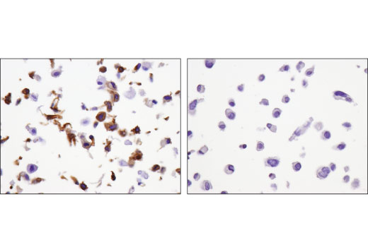 Immunohistochemistry Image 2: Calponin 1 (D8L2T) Rabbit Monoclonal Antibody