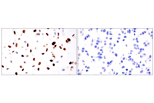Immunohistochemistry Image 2: SATB1 (E5Z3U) Rabbit Monoclonal Antibody