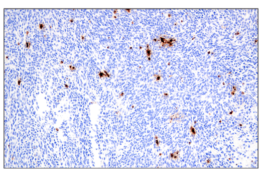 Immunohistochemistry Image 1: Granzyme B (E5V2L) Rabbit Monoclonal Antibody
