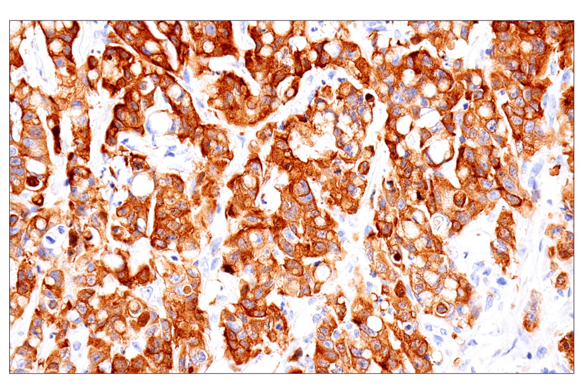 Immunohistochemistry Image 2: Asparagine Synthetase (E6C2C) Rabbit Monoclonal Antibody (BSA and Azide Free)