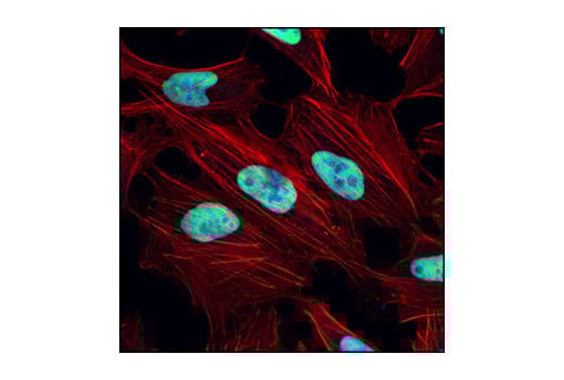 Immunofluorescence Image 1: Ku80 (C48E7) Rabbit Monoclonal Antibody (BSA and Azide Free)