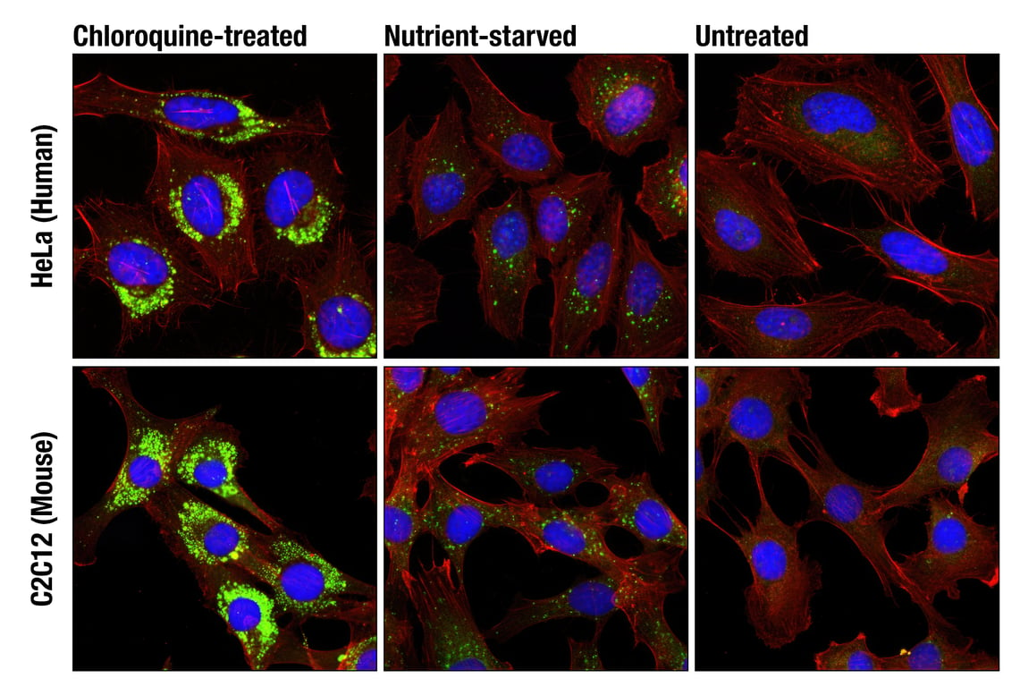 Immunofluorescence Image 1: LC3A/B (D3U4C) XP<sup>®</sup> Rabbit mAb