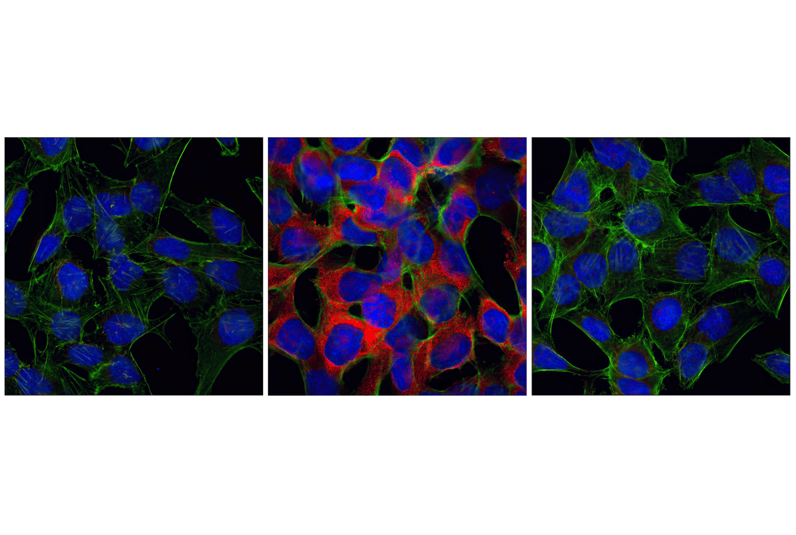 Immunofluorescence Image 1: Phospho-S6 Ribosomal Protein (Ser235/236) (91B2) Rabbit Monoclonal Antibody