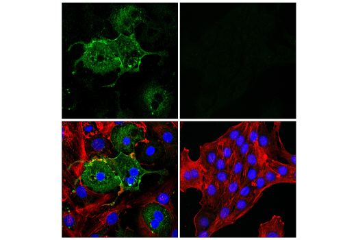 Immunofluorescence Image 1: CD36 (E8B7S) Rabbit Monoclonal Antibody