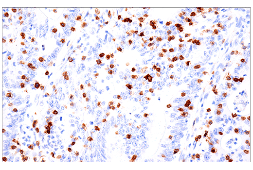 Immunohistochemistry Image 2: CD103/ITGAE (EP206) Rabbit Monoclonal Antibody