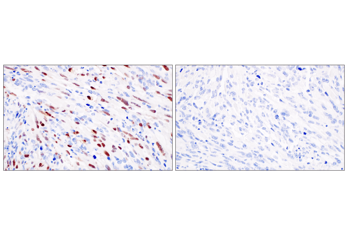 Immunohistochemistry Image 4: Myogenin (E9A1S) Rabbit Monoclonal Antibody