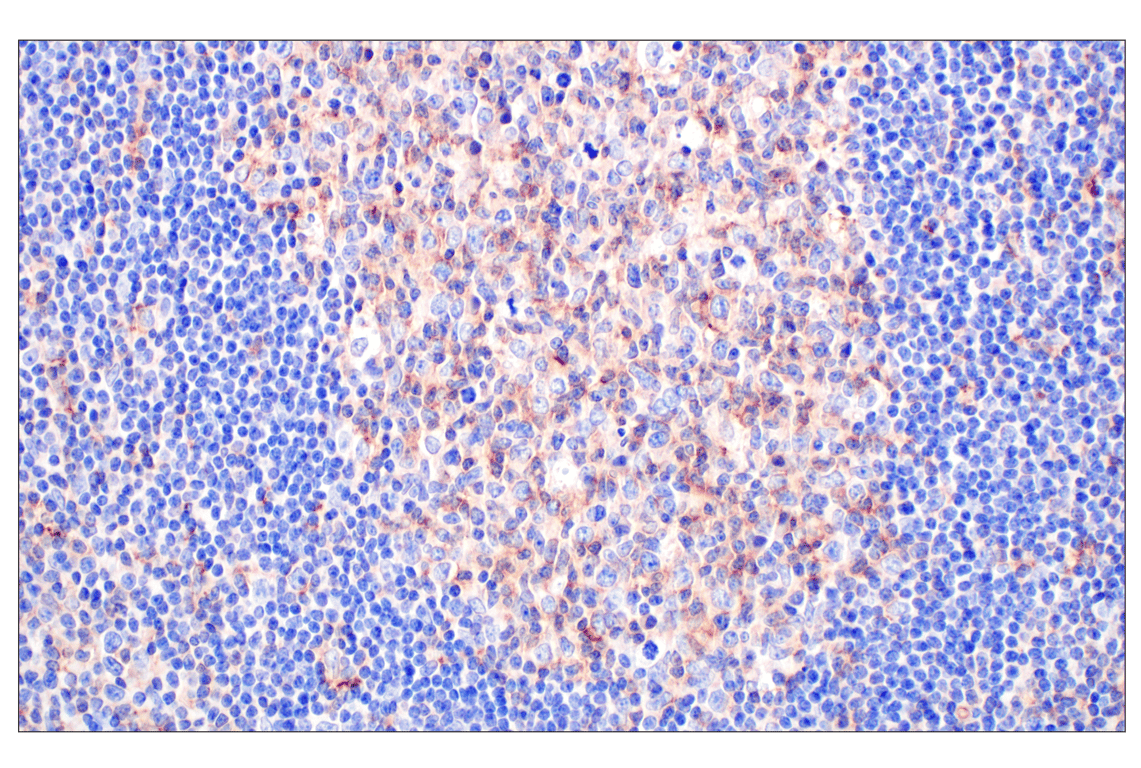Immunohistochemistry Image 9: CD58 (F1C9B) Rabbit Monoclonal Antibody