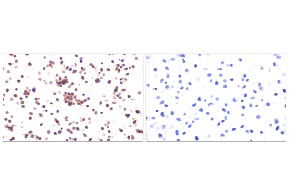 Immunohistochemistry Image 10: DAP12 (F1Q2P) Rabbit Monoclonal Antibody