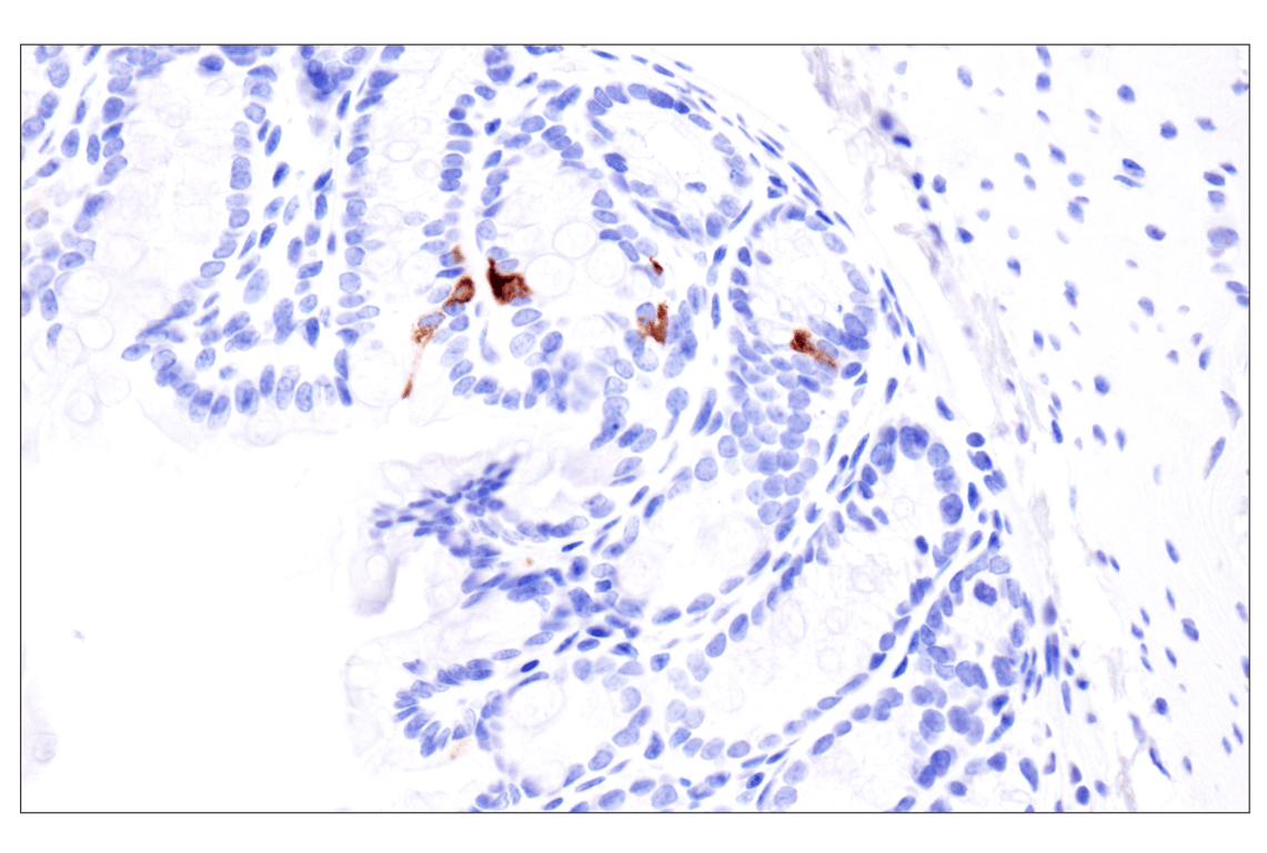 Immunohistochemistry Image 4: Pancreatic polypeptide (F8J4Y) Rabbit Monoclonal Antibody