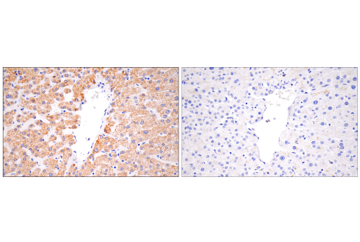 Immunohistochemistry Image 6: CPS1/Hep Par-1 (E9I9U) Rabbit Monoclonal Antibody