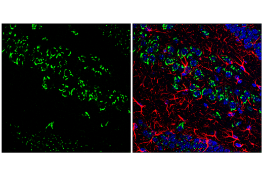 Immunofluorescence Image 1: Furin (E1W4O) Rabbit Monoclonal Antibody