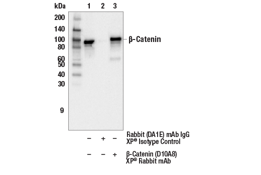 Immunoprecipitation Image 1: beta-Catenin (D10A8) Rabbit Monoclonal Antibody