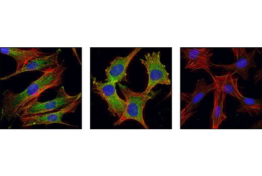 Immunofluorescence Image 1: GSK-3 alpha (D80D1) Rabbit Monoclonal Antibody