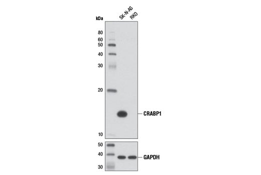 Western Blotting Image 2: CRABP1 (D5W9A) Rabbit Monoclonal Antibody
