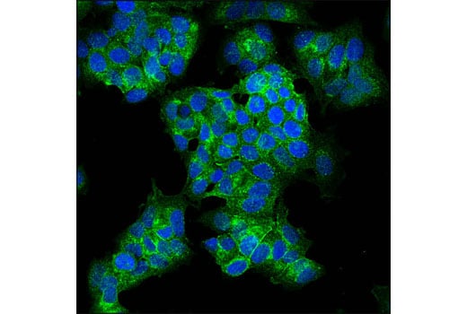 Immunofluorescence Image 1: Notch1 (D6F11) Rabbit Monoclonal Antibody