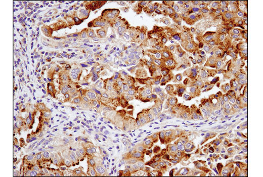 Immunohistochemistry Image 1: LAMTOR5/HBXIP (D4V4S) Rabbit Monoclonal Antibody