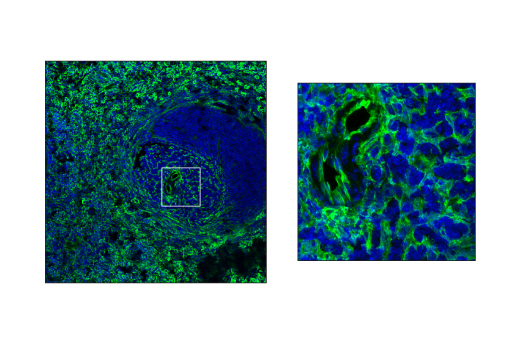 Immunofluorescence Image 2: VCAM-1 (D8U5V) Rabbit Monoclonal Antibody