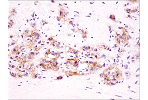 Immunohistochemistry Image 1: EphB4 (D1C7N) Rabbit Monoclonal Antibody