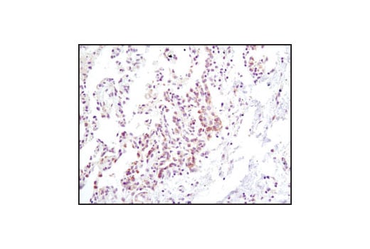 undefined Image 9: Jak Isoform Antibody Sampler Kit