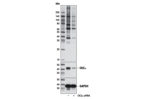Western Blotting Image 2: Phospho-CK2 Substrate [(pS/pT)DXE] MultiMab<sup>®</sup> Rabbit Monoclonal Antibody mix