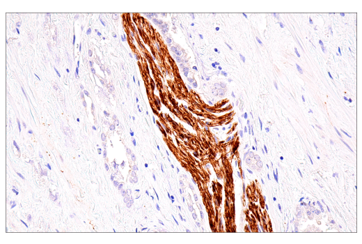 Immunohistochemistry Image 3: Neurofilament-M (E7L2T) Rabbit Monoclonal Antibody