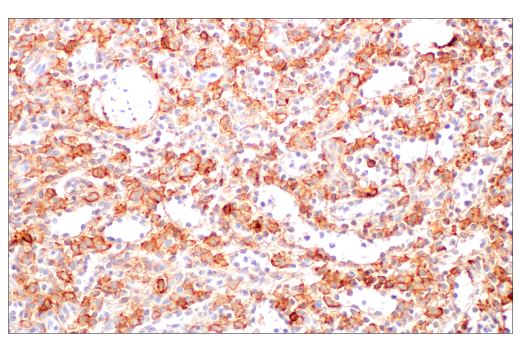 Immunohistochemistry Image 5: NCAM1 (CD56) (E7X9M) Rabbit Monoclonal Antibody