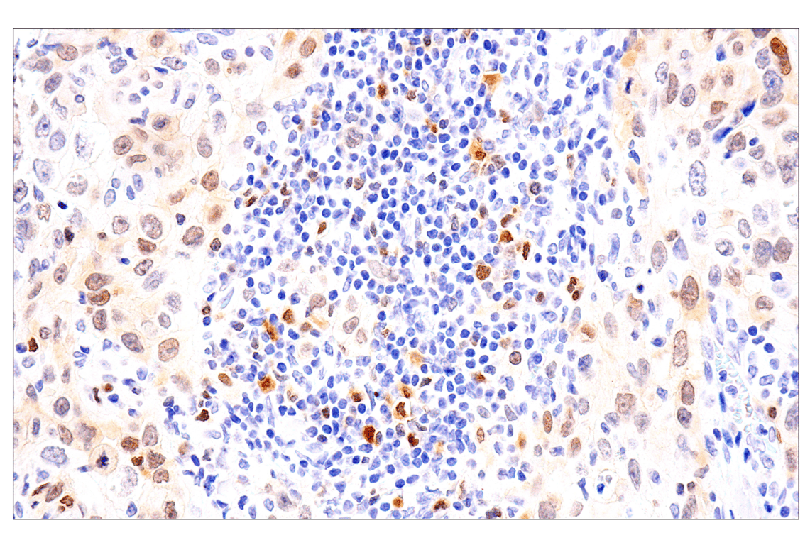 Immunohistochemistry Image 1: Chk1 (2G1D5) Mouse Monoclonal Antibody (BSA and Azide Free)