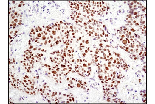 Immunohistochemistry Image 2: HES1 (D6P2U) Rabbit Monoclonal Antibody (BSA and Azide Free)