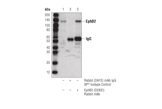 Immunoprecipitation Image 1: EphB2 (D2X2I) Rabbit Monoclonal Antibody