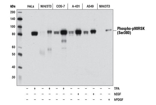 Western Blotting Image 1: Phospho-p90RSK (Ser380) (D3H11) Rabbit mAb (BSA and Azide Free)