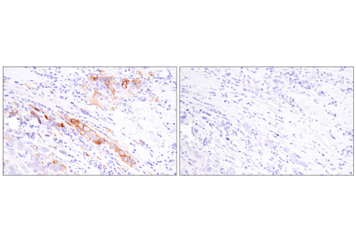 Immunohistochemistry Image 7: PAI-1 (E3I5H) Rabbit Monoclonal Antibody (BSA and Azide Free)