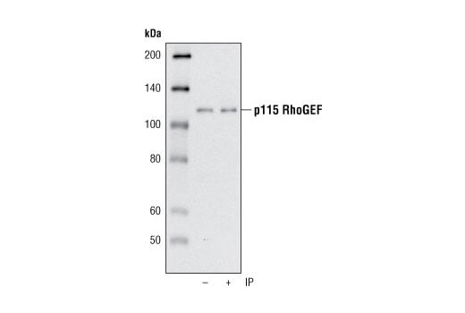 Immunoprecipitation Image 1: p115 RhoGEF (D25D2) XP<sup>®</sup> Rabbit mAb