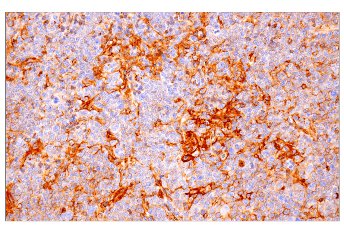 Immunohistochemistry Image 1: PD-L1 (F3Z1T) Rabbit Monoclonal Antibody (BSA and Azide Free)
