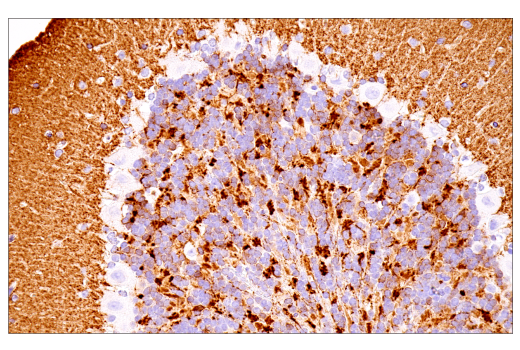 undefined Image 16: Genetics of Parkinson's Disease: Lysosomal Dysfunction Antibody Sampler Kit