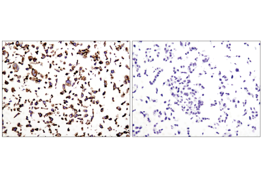 Immunohistochemistry Image 3: N-Cadherin (D4R1H) Rabbit Monoclonal Antibody (BSA and Azide Free)