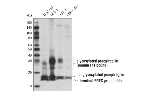 undefined Image 1: Cancer-associated Growth Factor Antibody Sampler Kit