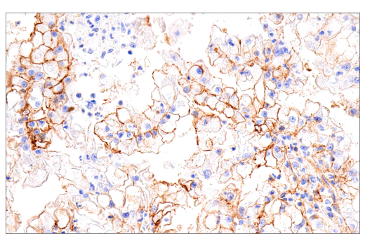 Immunohistochemistry Image 2: CD99 (PCB1) Mouse Monoclonal Antibody