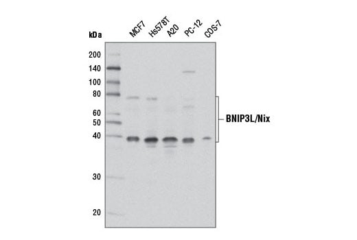 undefined Image 11: Mitophagy Antibody Sampler Kit